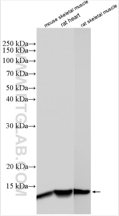 FABP4 Antibody in Western Blot (WB)