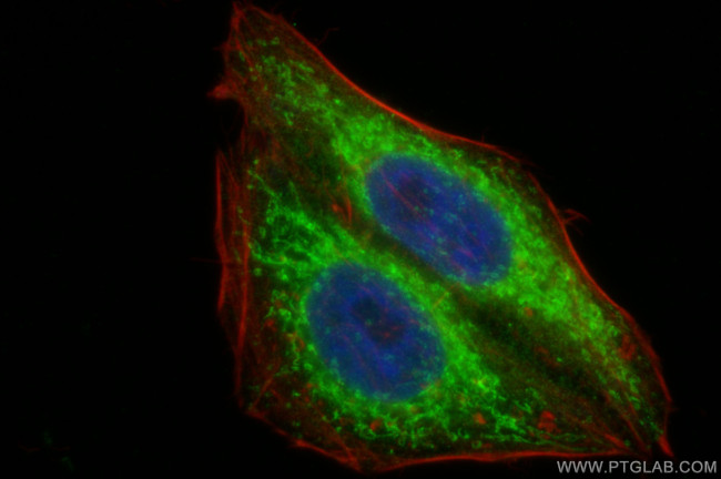 ND5 Antibody in Immunocytochemistry (ICC/IF)