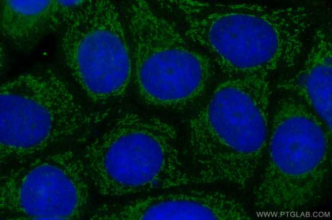 NRG1, isoform Beta1 Antibody in Immunocytochemistry (ICC/IF)