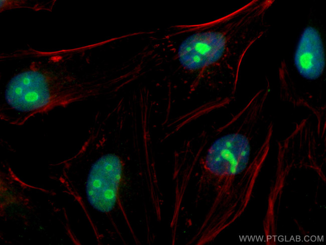 TBL3 Antibody in Immunocytochemistry (ICC/IF)