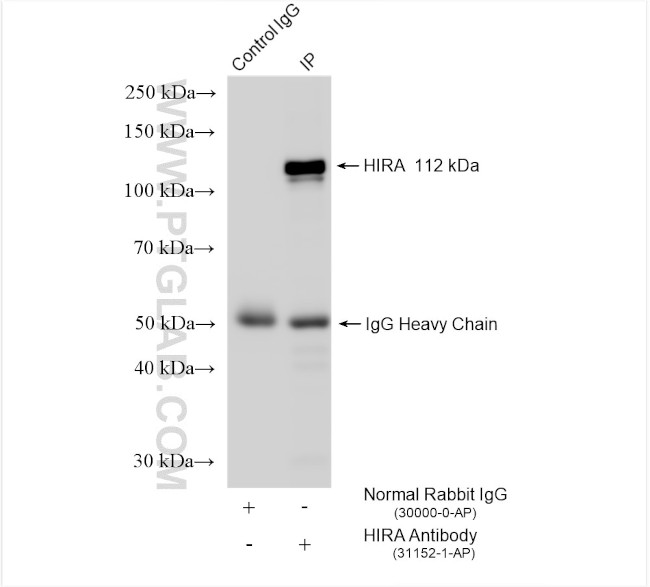 HIRA Antibody in Immunoprecipitation (IP)