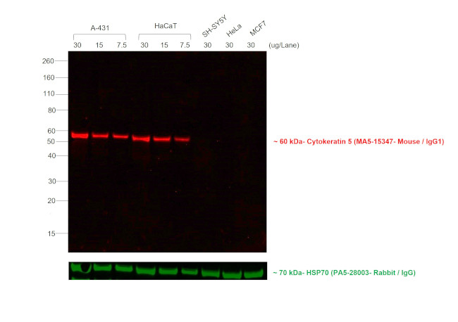 Mouse IgG (H+L) Secondary Antibody in Western Blot (WB)
