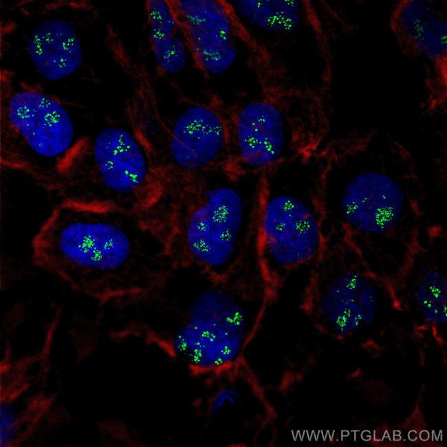 CD3EAP Antibody in Immunocytochemistry (ICC/IF)