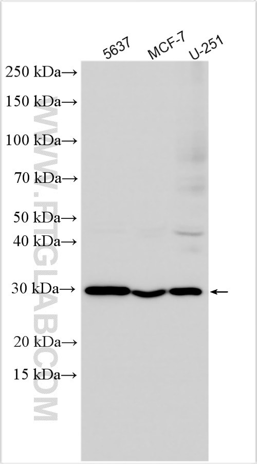 TRMT61A Antibody in Western Blot (WB)
