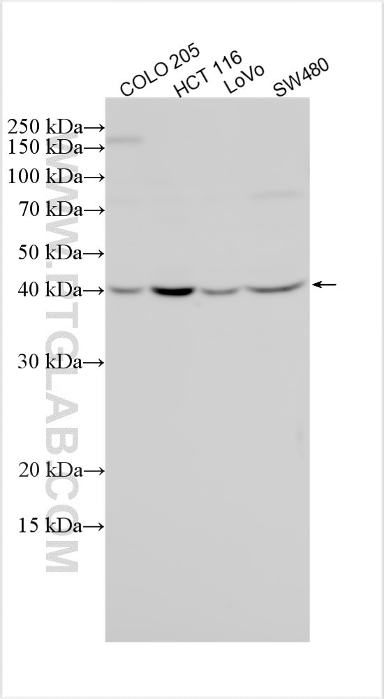 METTL8 Antibody in Western Blot (WB)