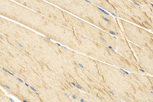 CMYA5 Antibody in Immunohistochemistry (Paraffin) (IHC (P))