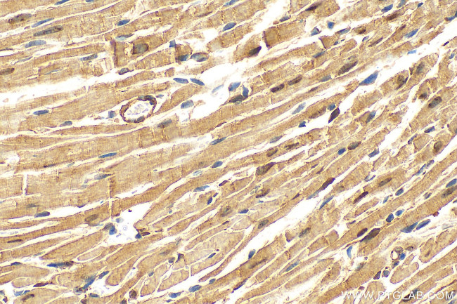 RBM20 Antibody in Immunohistochemistry (Paraffin) (IHC (P))