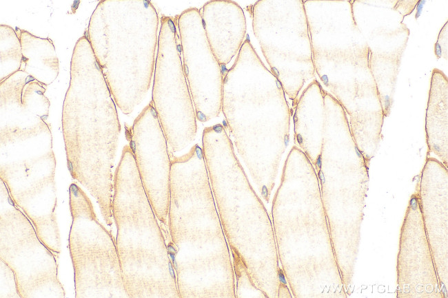 LAMA2 Antibody in Immunohistochemistry (Paraffin) (IHC (P))