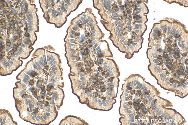 SLC2A7 Antibody in Immunohistochemistry (Paraffin) (IHC (P))