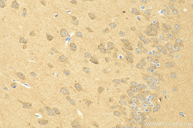 Cullin 5 Antibody in Immunohistochemistry (Paraffin) (IHC (P))