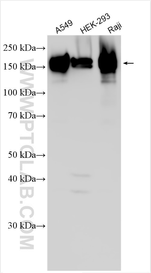 LRRFIP1 Antibody in Western Blot (WB)