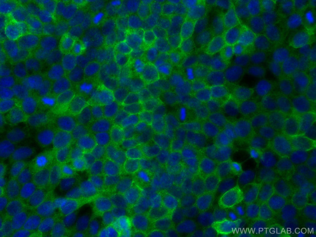 COL17A1 Antibody in Immunocytochemistry (ICC/IF)
