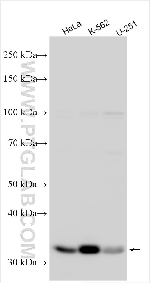 ABCA9 Antibody in Western Blot (WB)