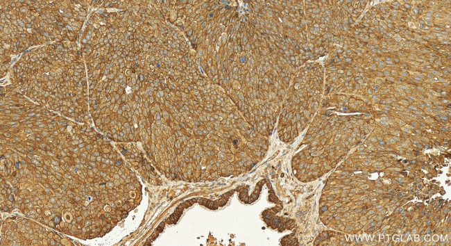 KIAA1522 Antibody in Immunohistochemistry (Paraffin) (IHC (P))