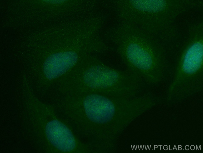 NCKAP5 Antibody in Immunocytochemistry (ICC/IF)