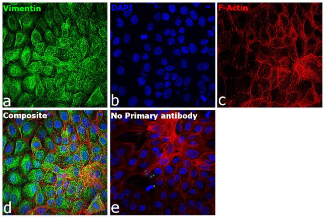Rabbit IgG (H+L) Secondary Antibody in Immunocytochemistry (ICC/IF)