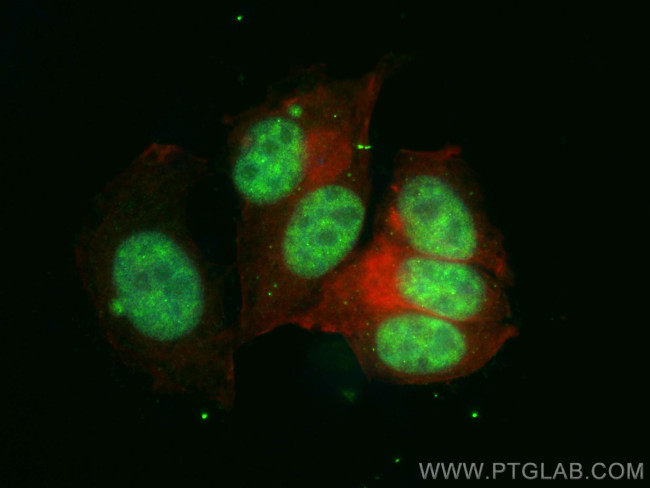 TSEN34 Antibody in Immunocytochemistry (ICC/IF)