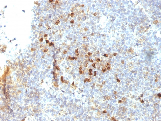 HLA-DRA (MHC II) Antibody in Immunohistochemistry (Paraffin) (IHC (P))