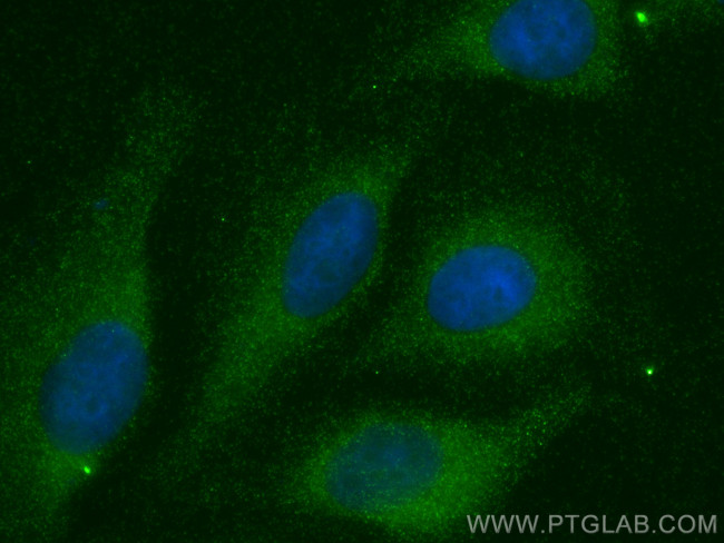CUL9 Antibody in Immunocytochemistry (ICC/IF)