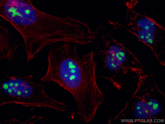 P14-ARF Antibody in Immunocytochemistry (ICC/IF)