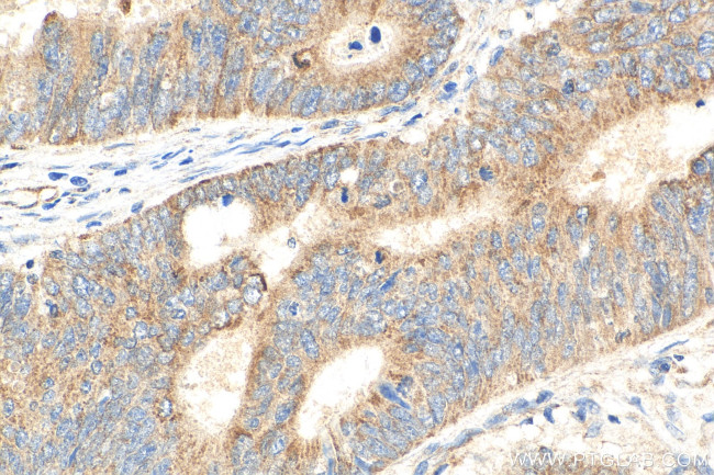 COX19 Antibody in Immunohistochemistry (Paraffin) (IHC (P))
