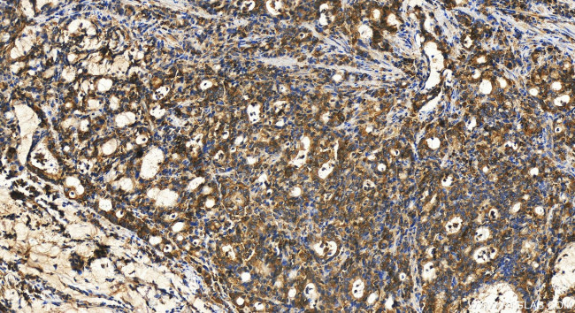 YARS Antibody in Immunohistochemistry (Paraffin) (IHC (P))