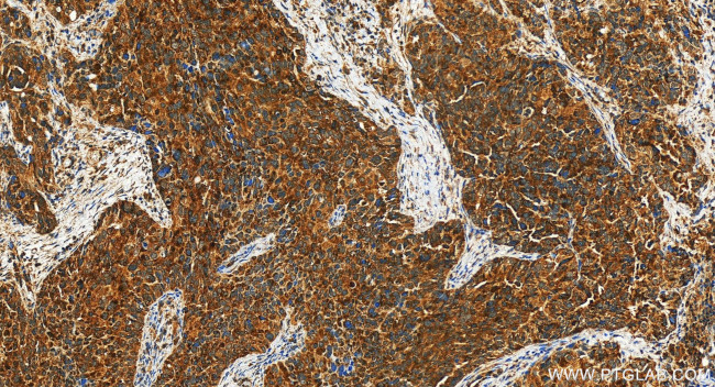 PIK3CG Antibody in Immunohistochemistry (Paraffin) (IHC (P))