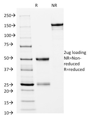 HLA-DRB (MHC II) Antibody in SDS-PAGE (SDS-PAGE)