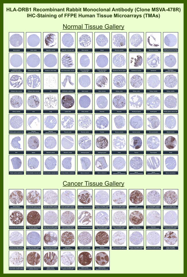 HLA-DRB (MHC II) Antibody in Immunohistochemistry (Paraffin) (IHC (P))