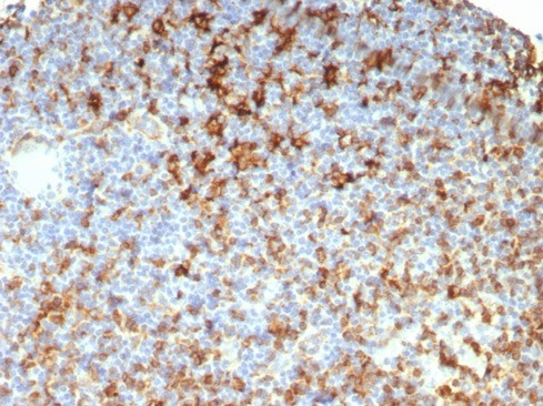 HLA-DRB (MHC II) Antibody in Immunohistochemistry (Paraffin) (IHC (P))