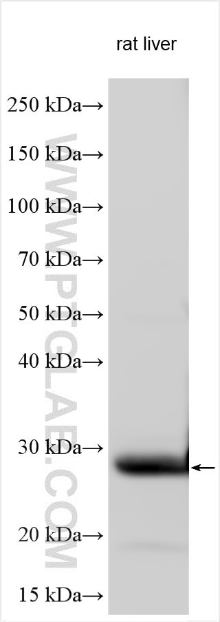 RTTN Antibody in Western Blot (WB)