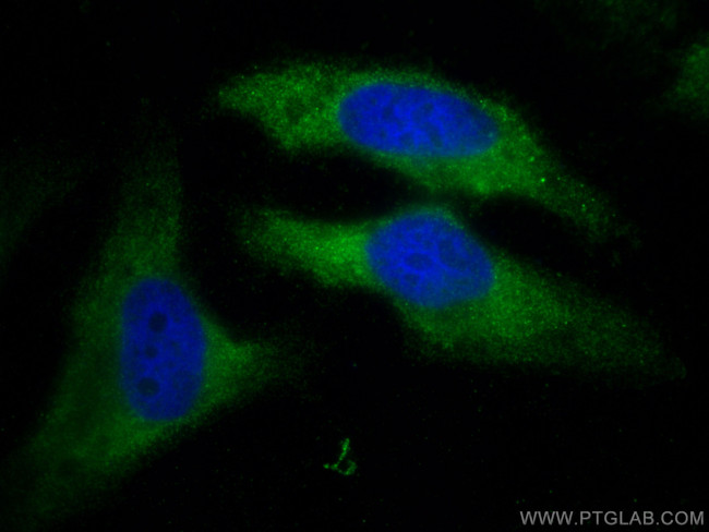 RC3H1 Antibody in Immunocytochemistry (ICC/IF)