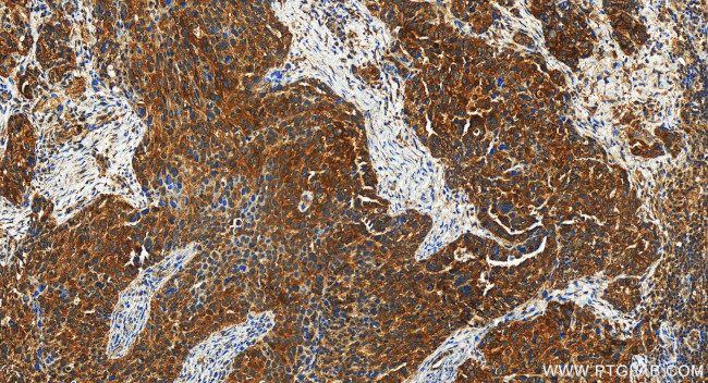 IGFBP2 Antibody in Immunohistochemistry (Paraffin) (IHC (P))
