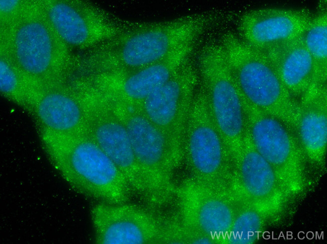 AFP Antibody in Immunocytochemistry (ICC/IF)
