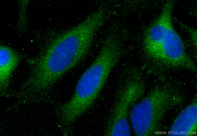APOA1 Antibody in Immunocytochemistry (ICC/IF)