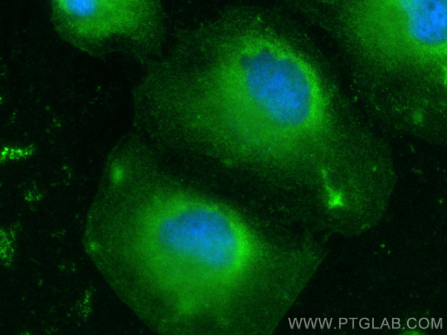 CBR1 Antibody in Immunocytochemistry (ICC/IF)