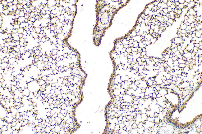 DNAH11 Antibody in Immunohistochemistry (Paraffin) (IHC (P))