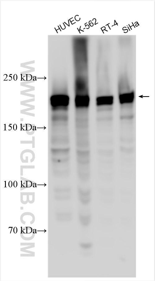 FBXO38 Antibody in Western Blot (WB)