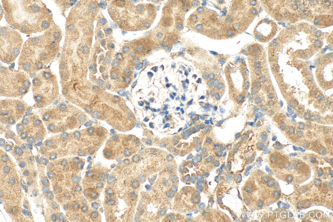 FNIP2 Antibody in Immunohistochemistry (Paraffin) (IHC (P))