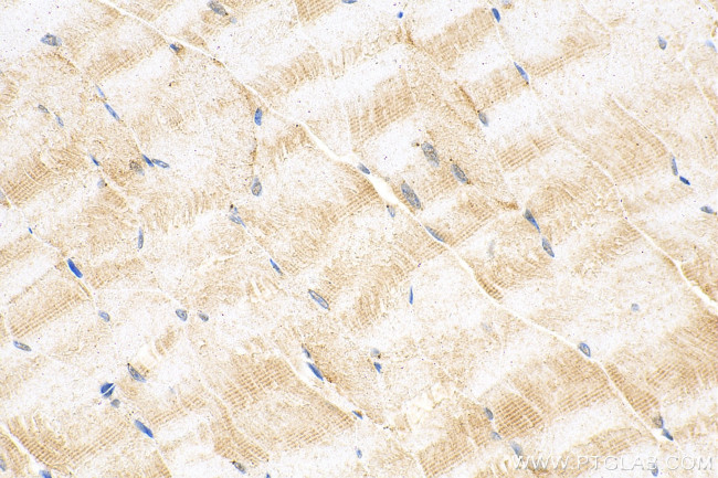 RASA4B Antibody in Immunohistochemistry (Paraffin) (IHC (P))