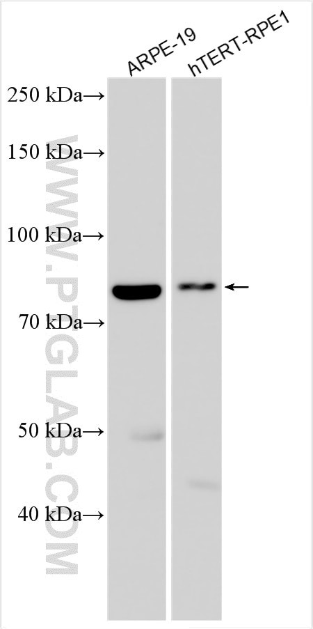 SLC24A2 Antibody in Western Blot (WB)
