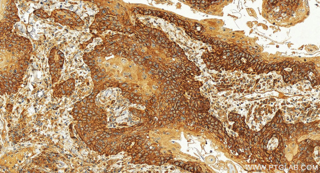 Tyrosinase Antibody in Immunohistochemistry (Paraffin) (IHC (P))