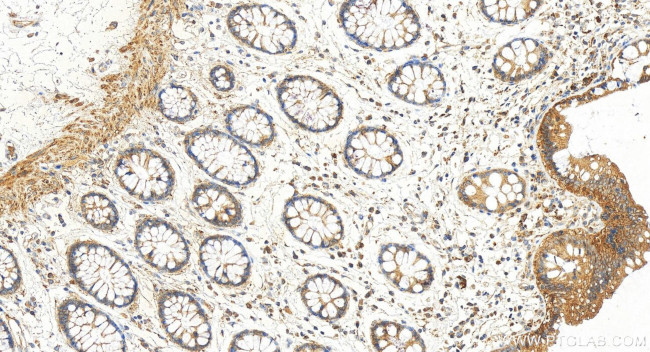 TMEM189 Antibody in Immunohistochemistry (Paraffin) (IHC (P))
