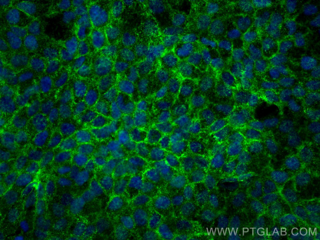 PPL Antibody in Immunocytochemistry (ICC/IF)