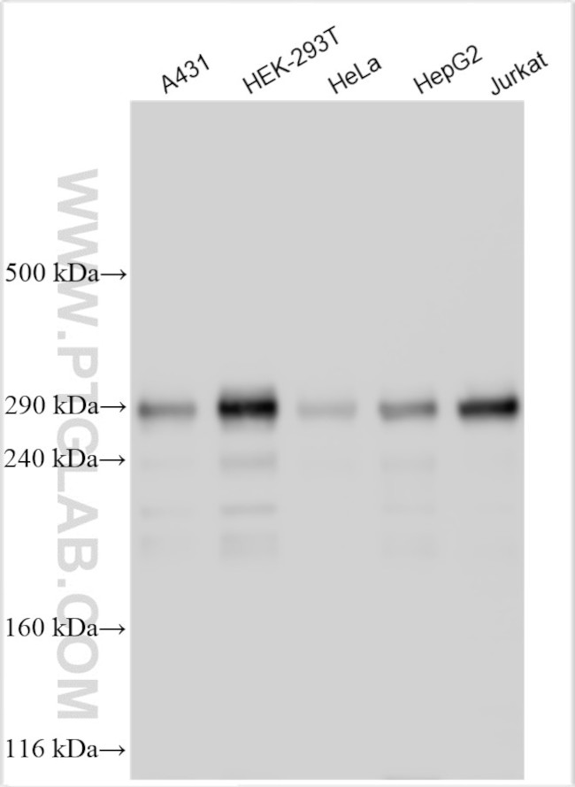 ZNF638 Antibody in Western Blot (WB)