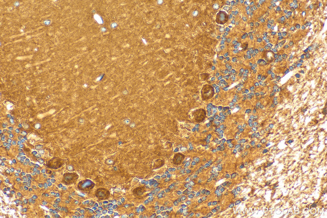 KIAA1715 Antibody in Immunohistochemistry (Paraffin) (IHC (P))