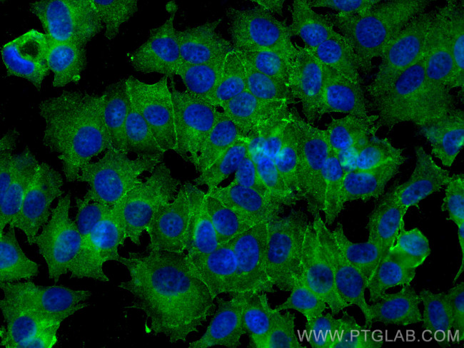 Pan-cadherin Antibody in Immunocytochemistry (ICC/IF)
