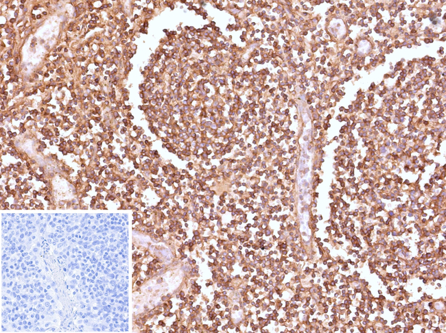 HLA-E (Major histocompatibility complex, class I, E) Antibody in Immunohistochemistry (Paraffin) (IHC (P))