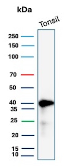 HLA-E (Major histocompatibility complex, class I, E) Antibody in Western Blot (WB)