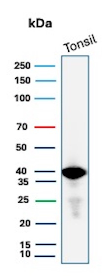 HLA-E (Major histocompatibility complex, class I, E) Antibody in Western Blot (WB)
